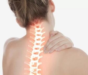 Cervical osteocondrosis
