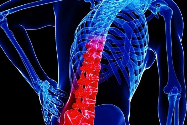 Reasons for the development of thorakal osteocondrosis