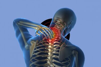 Pain in the neck with osteocondrosis